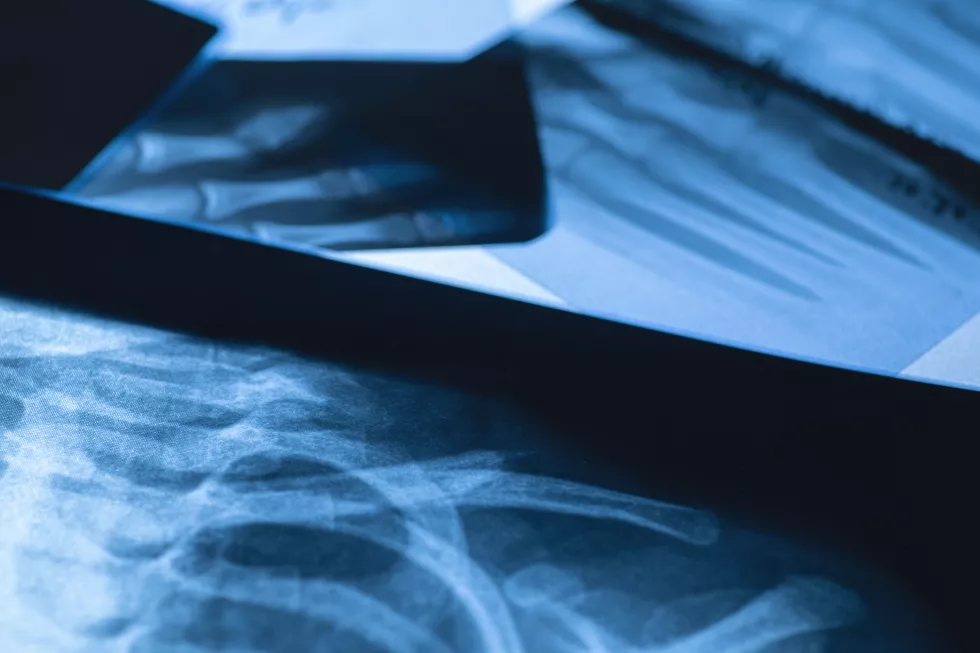 closeup-different-x-ray-images-table