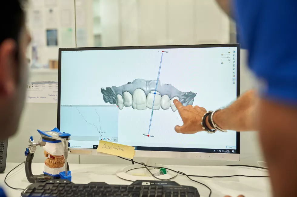 crop-blurred-anonymous-dentists-pointing-monitor-while-modeling-denture-computer-while-working-together-modern-light-dental-clinic