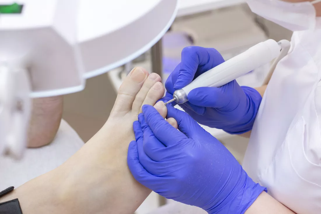 therapeutic-pedicure-master-podologist-does-hardware-pedicure-visit-podiatry-foot-treatment-spa-clinic-podiatria